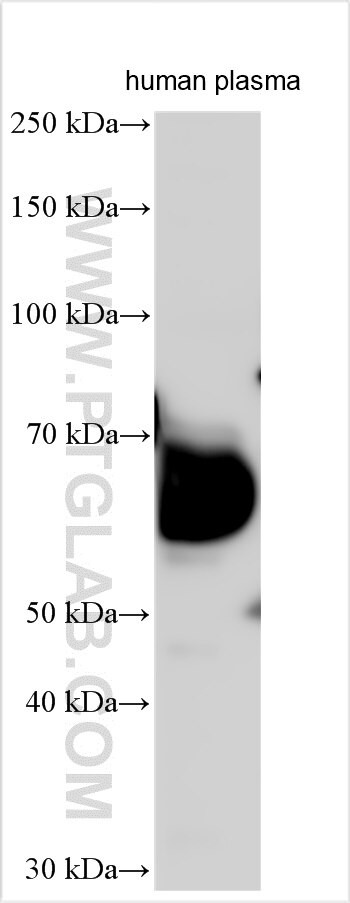 UST Antibody in Western Blot (WB)