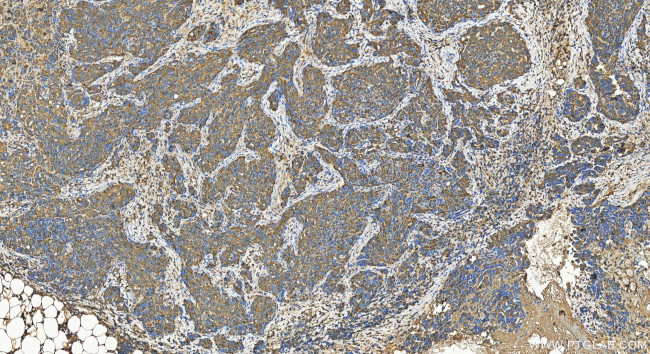 TRANK1 Antibody in Immunohistochemistry (Paraffin) (IHC (P))