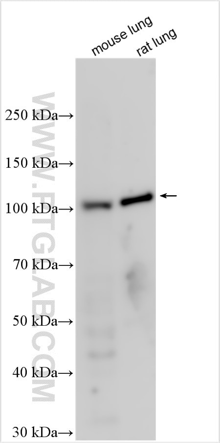 TERT Antibody in Western Blot (WB)