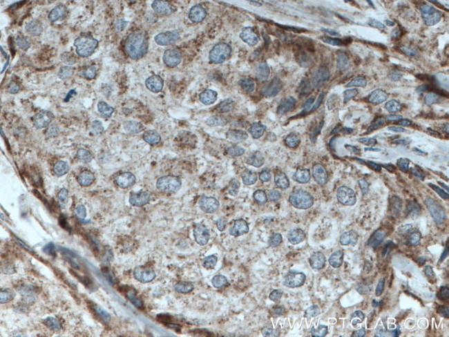 C3orf64 Antibody in Immunohistochemistry (Paraffin) (IHC (P))