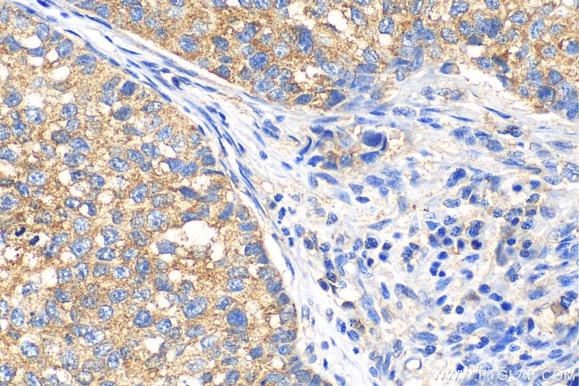 Fibroblast activation protein alpha Antibody in Immunohistochemistry (Paraffin) (IHC (P))