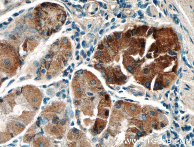 LRBA Antibody in Immunohistochemistry (Paraffin) (IHC (P))