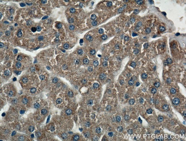 CIDEB Antibody in Immunohistochemistry (Paraffin) (IHC (P))