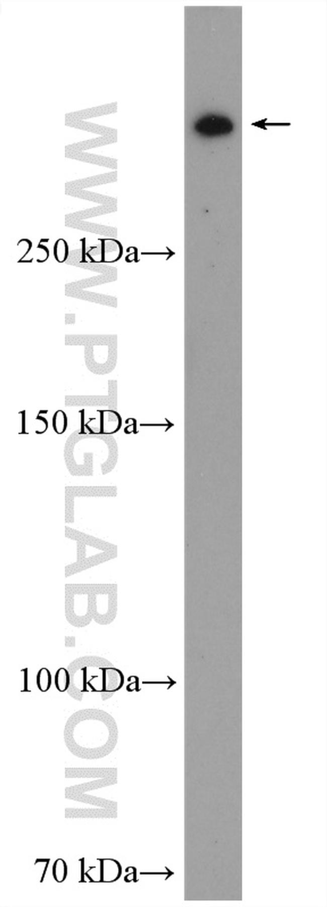 RanBP2 Antibody in Western Blot (WB)