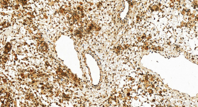 SIK2 Antibody in Immunohistochemistry (Paraffin) (IHC (P))