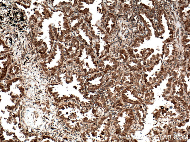 C21orf2 Antibody in Immunohistochemistry (Paraffin) (IHC (P))