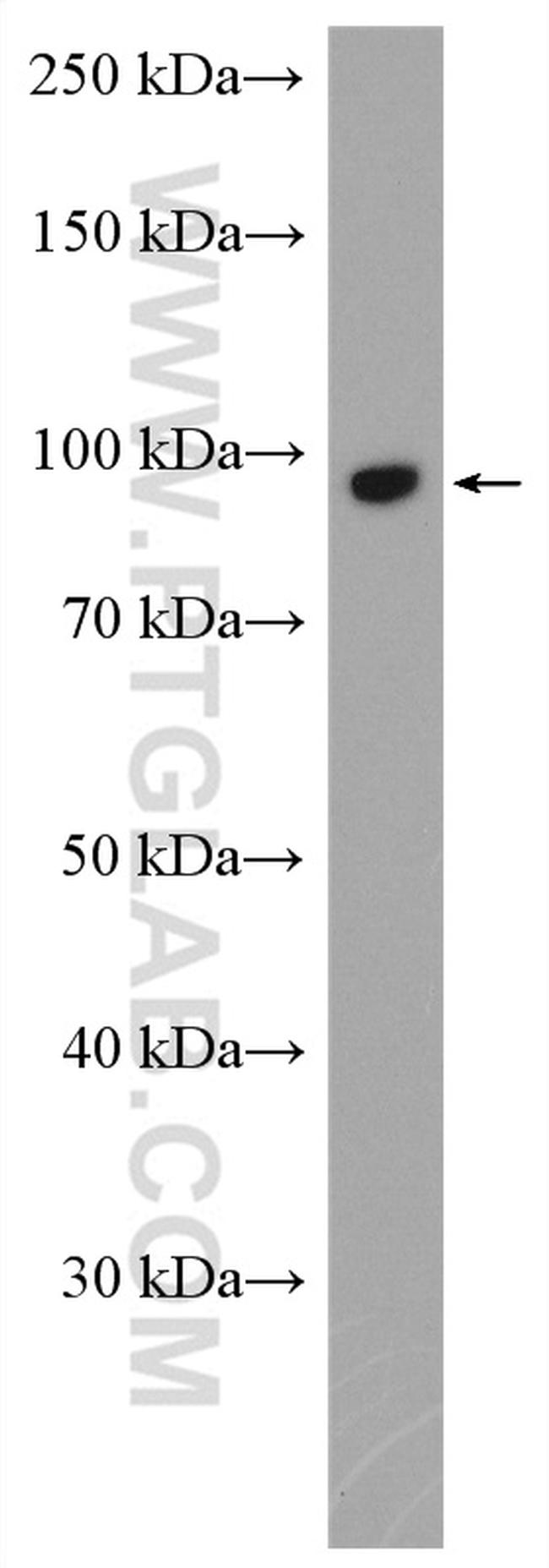 FBXO11 Antibody in Western Blot (WB)