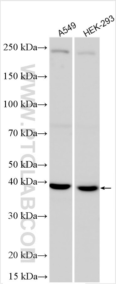 FPGS Antibody in Western Blot (WB)