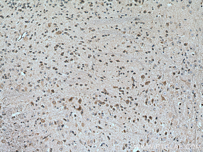 TMC2 Antibody in Immunohistochemistry (Paraffin) (IHC (P))