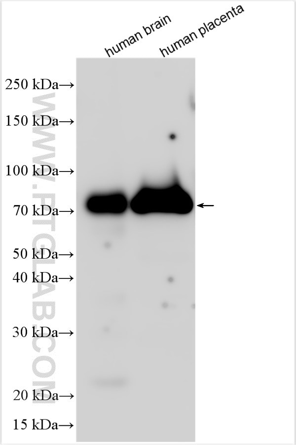 HOXA5 Antibody in Western Blot (WB)