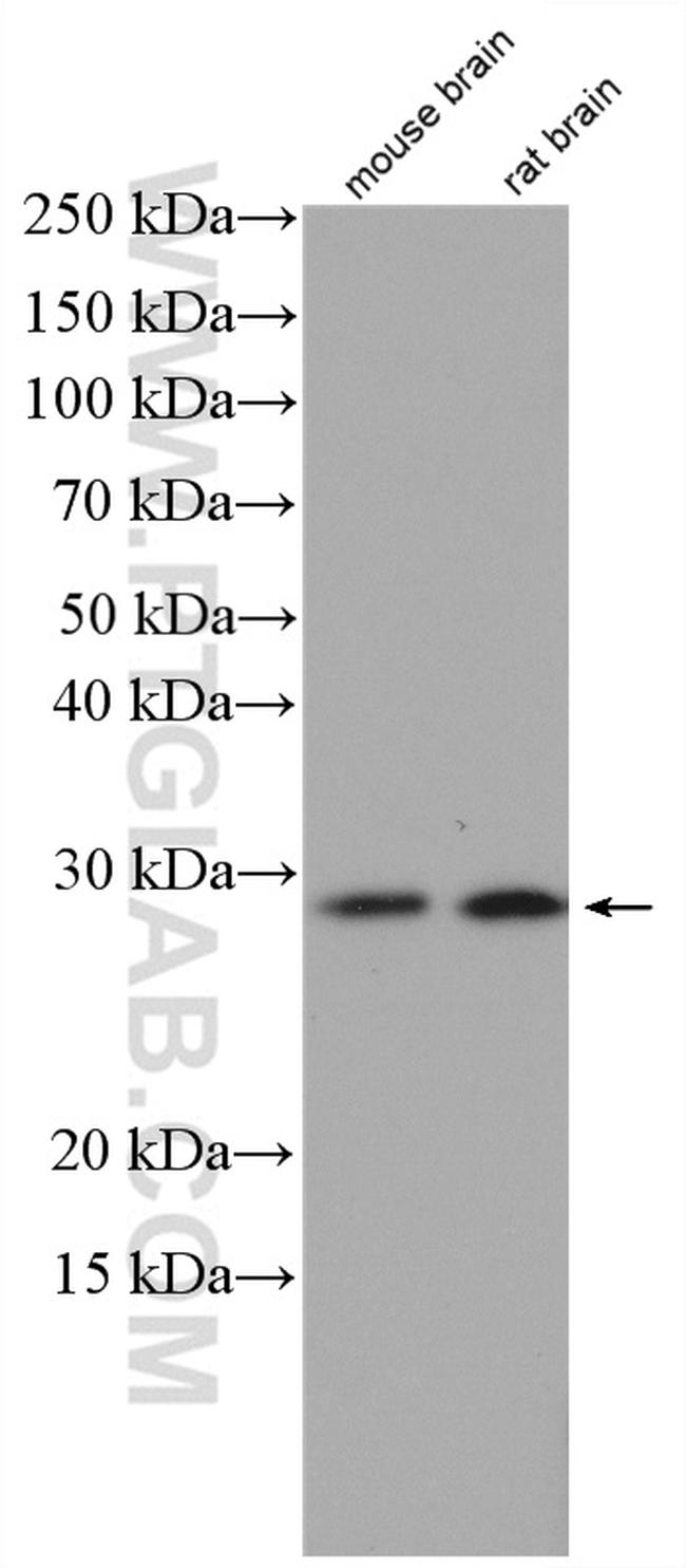DBNDD2 Antibody in Western Blot (WB)