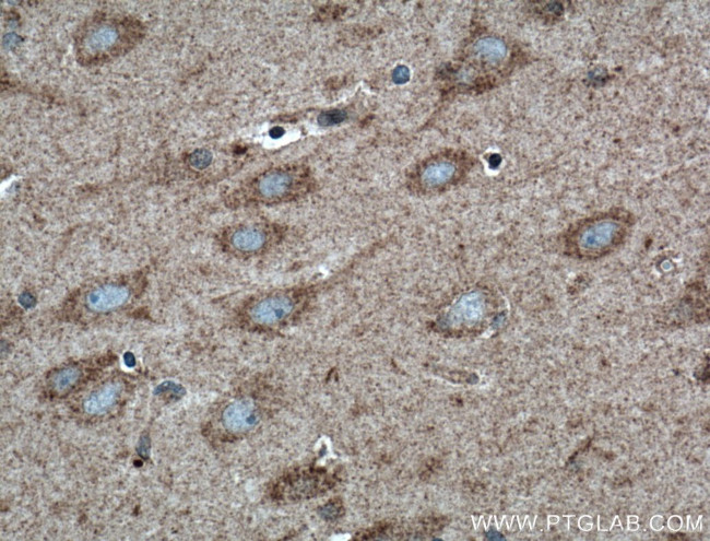 WDR8 Antibody in Immunohistochemistry (Paraffin) (IHC (P))