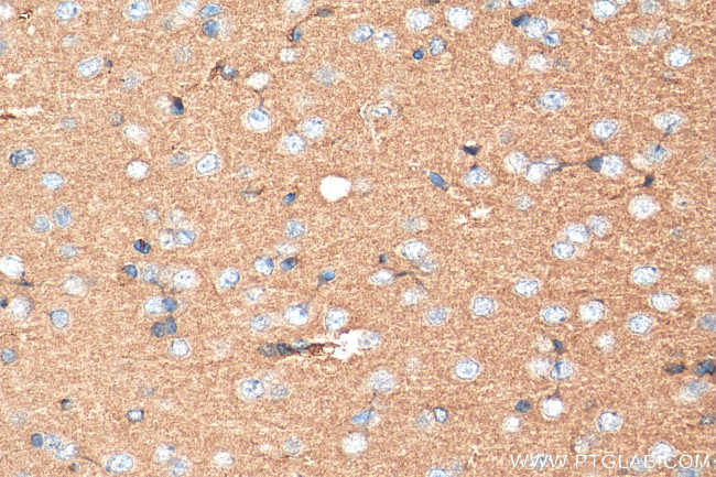 SLC38A6 Antibody in Immunohistochemistry (Paraffin) (IHC (P))