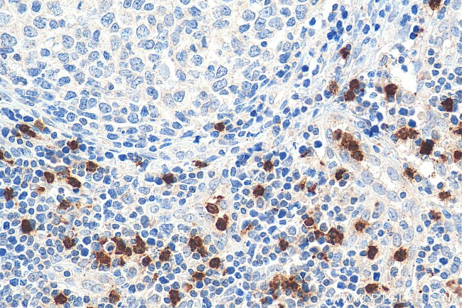ELA2 Antibody in Immunohistochemistry (Paraffin) (IHC (P))