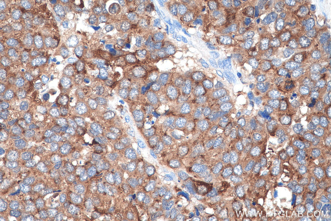 TPD52 Antibody in Immunohistochemistry (Paraffin) (IHC (P))