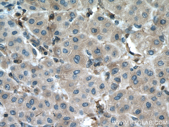 DPYD Antibody in Immunohistochemistry (Paraffin) (IHC (P))