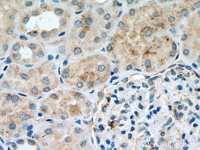 EPG5 Antibody in Immunohistochemistry (Paraffin) (IHC (P))