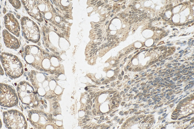 RSL1D1 Antibody in Immunohistochemistry (Paraffin) (IHC (P))