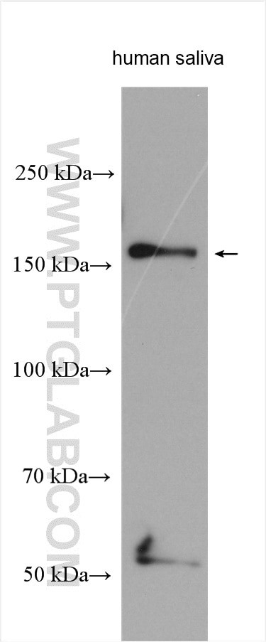 A2ML1 Antibody in Western Blot (WB)