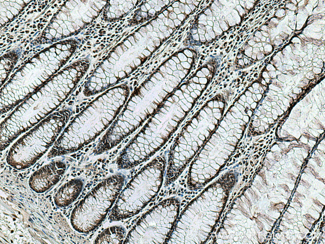 RREB1 Antibody in Immunohistochemistry (Paraffin) (IHC (P))