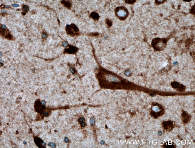 TMEM85 Antibody in Immunohistochemistry (Paraffin) (IHC (P))