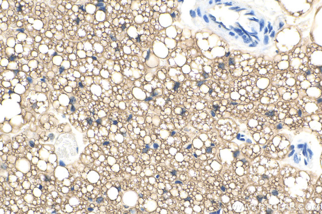 Perilipin 1 Antibody in Immunohistochemistry (Paraffin) (IHC (P))