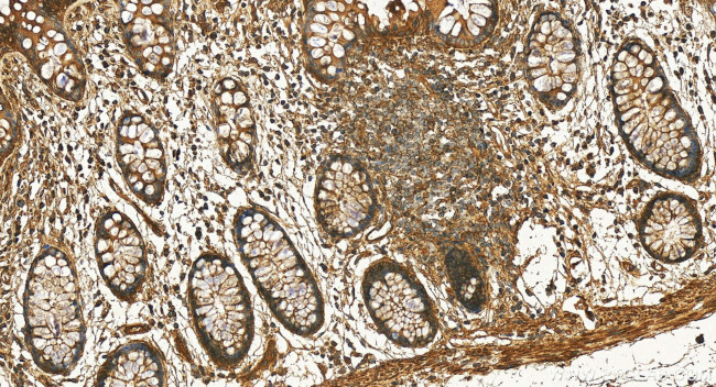 FAR2 Antibody in Immunohistochemistry (Paraffin) (IHC (P))