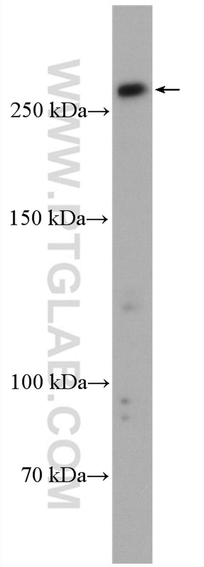 PRDM2 Antibody in Western Blot (WB)