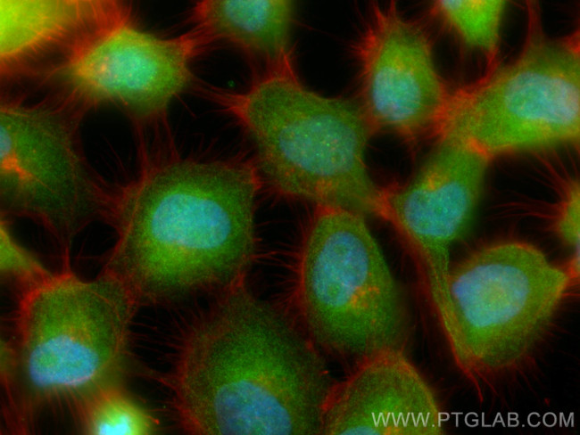 Flightless I Antibody in Immunocytochemistry (ICC/IF)