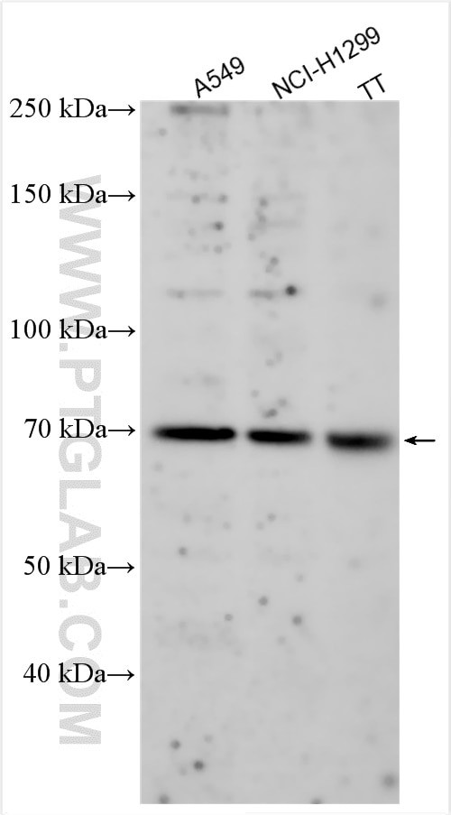 MFSD6L Antibody in Western Blot (WB)
