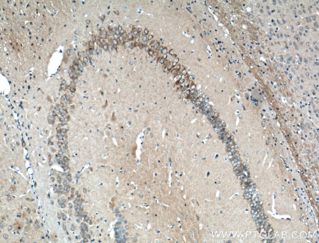 OPA1 Antibody in Immunohistochemistry (Paraffin) (IHC (P))