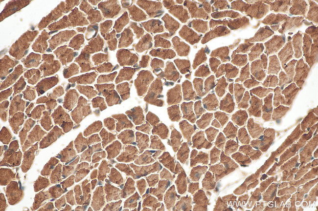 Nexilin Antibody in Immunohistochemistry (Paraffin) (IHC (P))