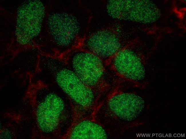Histone H2B Antibody in Immunocytochemistry (ICC/IF)