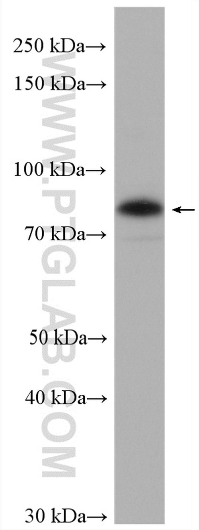 TRAFD1 Antibody in Western Blot (WB)