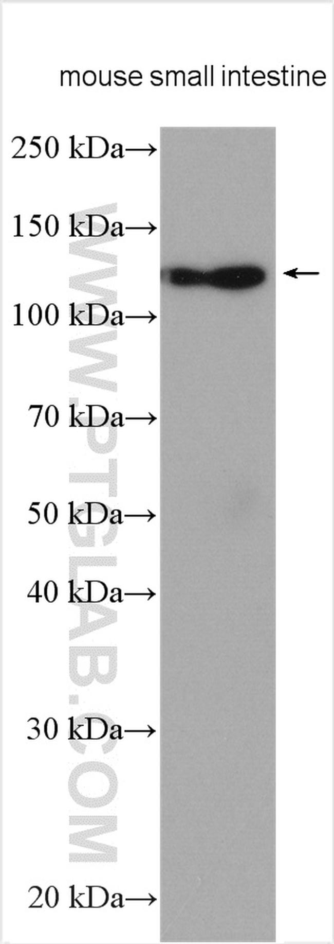 ASAH2 Antibody in Western Blot (WB)