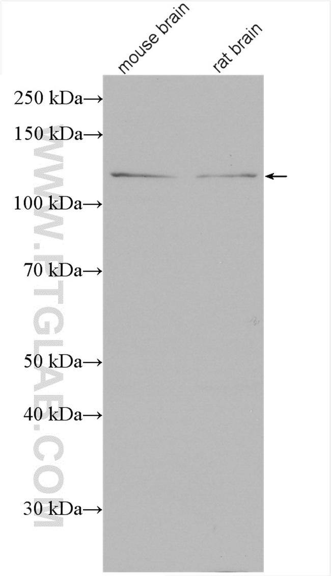 Syndetin/CCDC132 Antibody in Western Blot (WB)