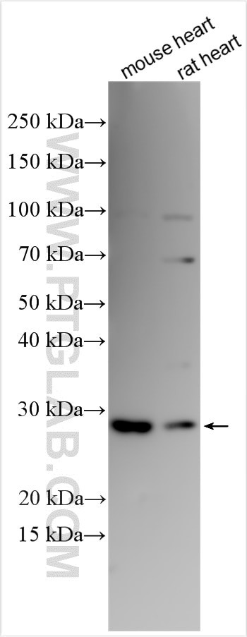 RRAD Antibody in Western Blot (WB)