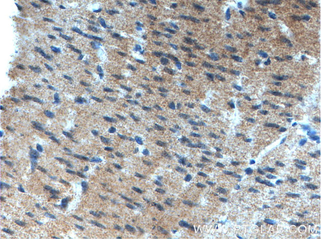 GET4 Antibody in Immunohistochemistry (Paraffin) (IHC (P))