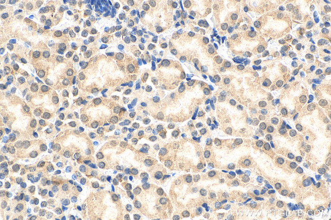 HSPBAP1 Antibody in Immunohistochemistry (Paraffin) (IHC (P))