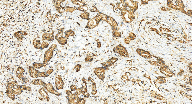 TRAPPC11 Antibody in Immunohistochemistry (Paraffin) (IHC (P))