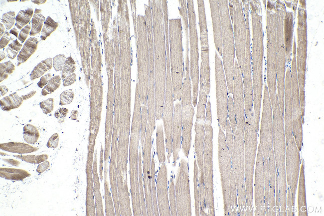 CSDA Antibody in Immunohistochemistry (Paraffin) (IHC (P))