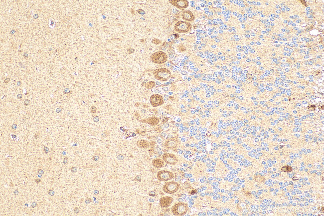 PNPLA7 Antibody in Immunohistochemistry (Paraffin) (IHC (P))