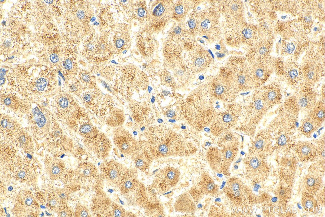 SPG7 Antibody in Immunohistochemistry (Paraffin) (IHC (P))