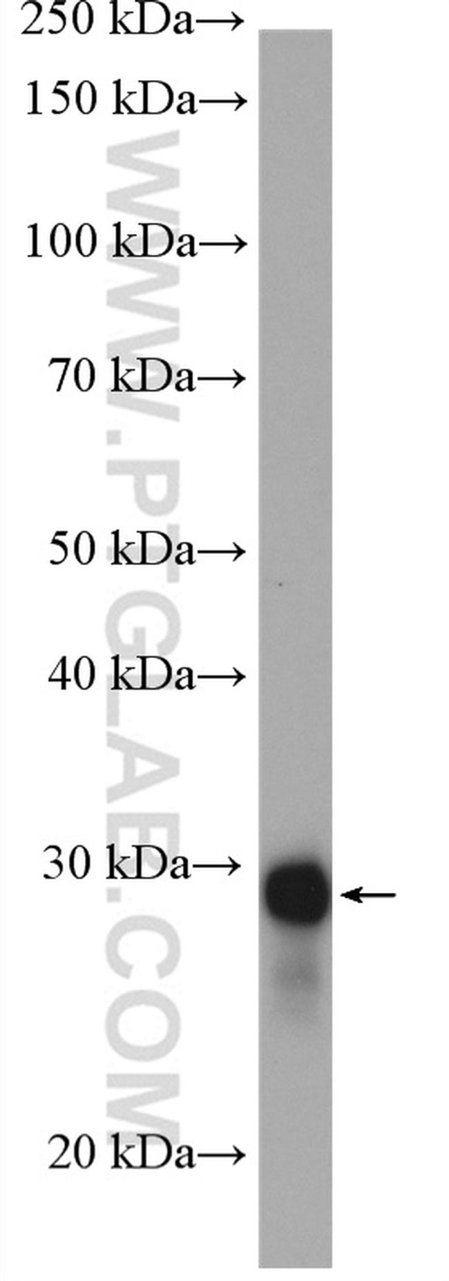 RanBP1 Antibody in Western Blot (WB)