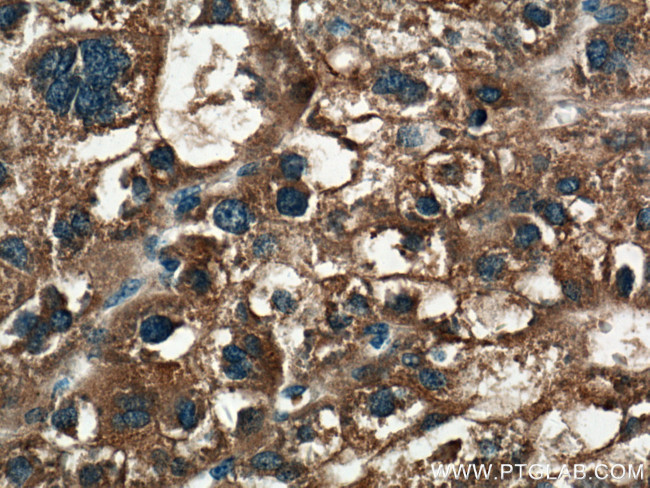 PPP4R1 Antibody in Immunohistochemistry (Paraffin) (IHC (P))