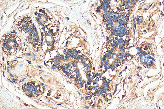 MRP1 Antibody in Immunohistochemistry (Paraffin) (IHC (P))