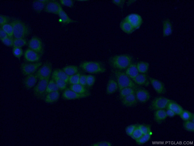 MTSS1L Antibody in Immunocytochemistry (ICC/IF)