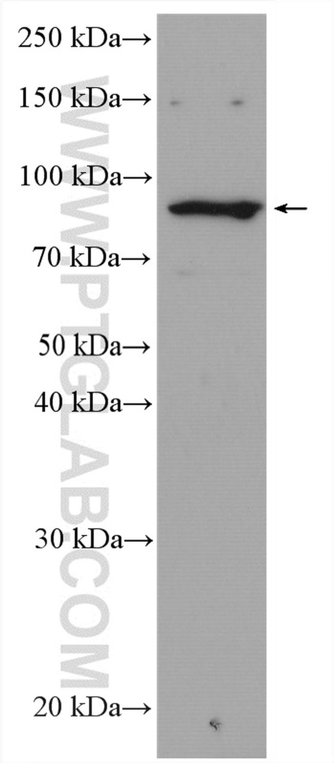 RASA2/3 Antibody in Western Blot (WB)