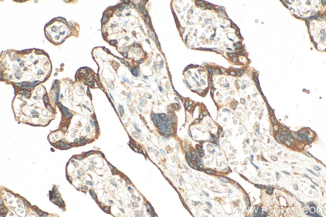 GDF15 Antibody in Immunohistochemistry (Paraffin) (IHC (P))
