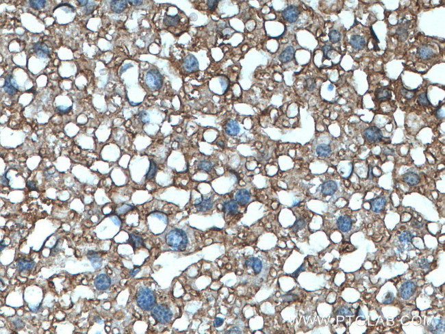ABCC6 Antibody in Immunohistochemistry (Paraffin) (IHC (P))